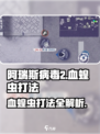 阿瑞斯病毒2🔥血蝗虫打法攻略，轻松取胜秘籍！