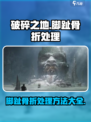 破碎之地脚趾骨折？游戏技巧💡大揭秘！