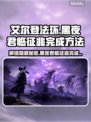 艾尔登法环黑夜君临征兆完成方法大公开！🎮🔥