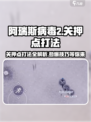 阿瑞斯病毒2关押点打法🔥超详细攻略来啦！