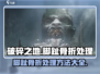 《破碎之地》脚趾骨折？别慌！⚡快速处理秘籍🎉