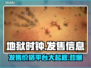地狱时钟发售价格曝光！🔥游戏平台大揭秘🎮