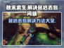 秋末求生延迟丢包？❌解决方法来了！🔥